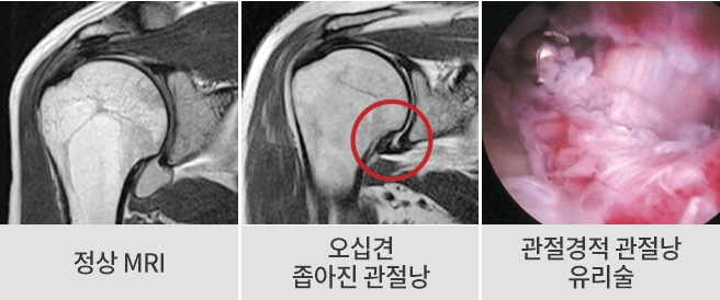 수술 전후 이미지